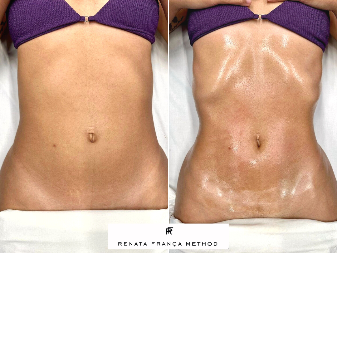 90-minute Full Body Colombian x Brazilian Lymphatic Sculpt