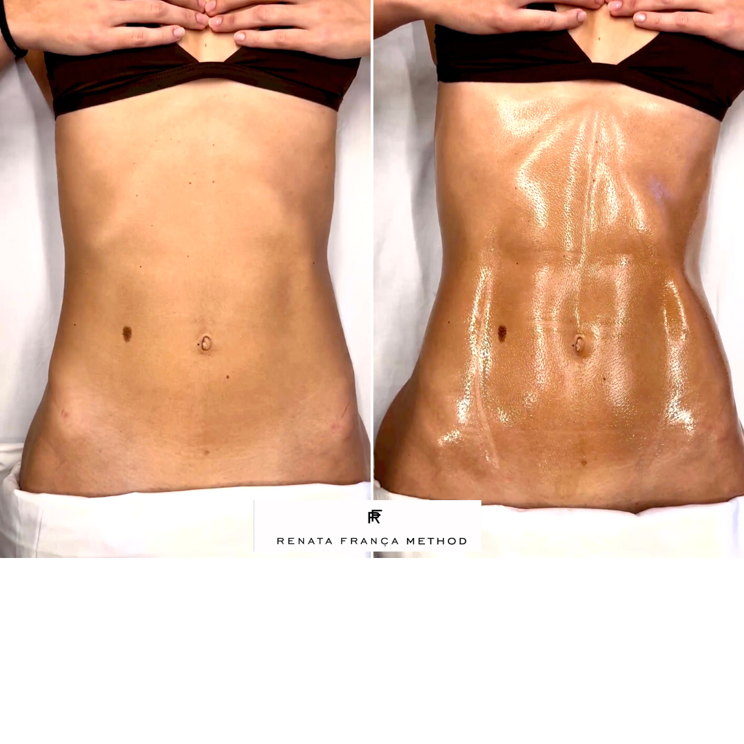 60-minute Full Body Colombian Wood Therapy